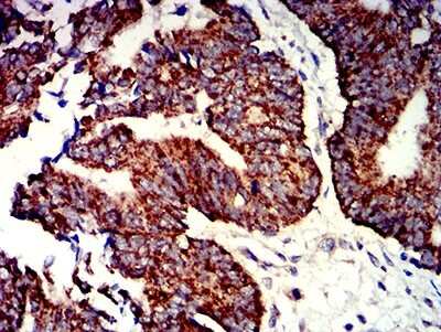 Immunohistochemistry-Paraffin: P2Y1/P2RY1 Antibody (4G5D6) - BSA Free [NBP2-61664]