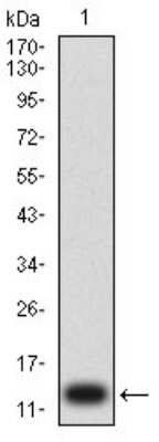 Western Blot: P2Y1/P2RY1 Antibody (4G5D6)BSA Free [NBP2-61664]