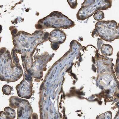 Immunohistochemistry-Paraffin: P2Y1/P2RY1 Antibody [NBP1-82439]