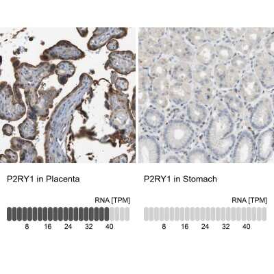 Immunohistochemistry-Paraffin: P2Y1/P2RY1 Antibody [NBP1-82439]