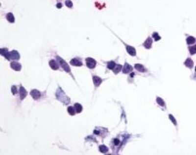 Immunohistochemistry-Paraffin: P2Y1/P2RY1 Antibody - BSA Free [NLS3795]