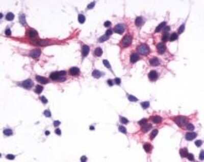 Immunohistochemistry-Paraffin: P2Y1/P2RY1 Antibody - BSA Free [NLS3795]