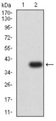 Western Blot: P2Y12/P2RY12 Antibody (1C2A9)BSA Free [NBP2-61749]