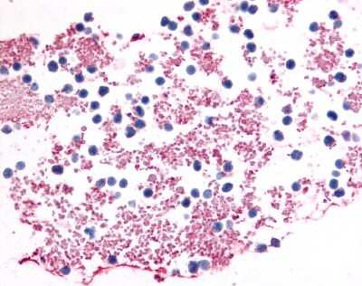 Immunohistochemistry-Paraffin: P2Y12/P2RY12 Antibody - BSA Free [NLS3742]