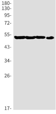 Western Blot: P2Y12/P2RY12 Antibody (S02-2E1) [NBP3-19903]
