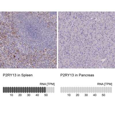 Immunohistochemistry-Paraffin: P2Y13/P2RY13/GPR86 Antibody [NBP2-13721]