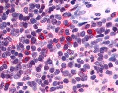 Immunohistochemistry-Paraffin: P2Y13/P2RY13/GPR86 Antibody - BSA Free [NLS1622]