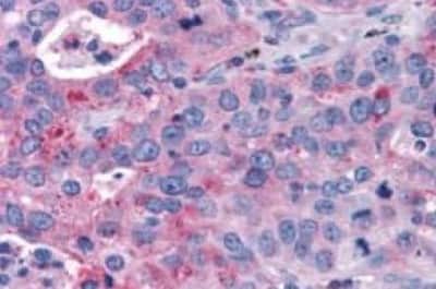Immunohistochemistry: P2Y14/GPR105 Antibody [NBP3-14438]