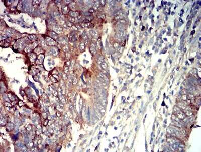 Immunohistochemistry: P2Y14/GPR105 Antibody (5A3F1) - BSA Free [NBP2-61753]