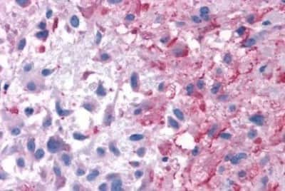 Immunohistochemistry-Paraffin: P2Y14/GPR105 Antibody [NBP3-14438]