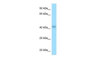 Western Blot: P2Y2 Antibody [NBP2-86745]