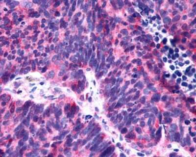 Immunohistochemistry-Paraffin: P2Y6/P2RY6 Antibody - BSA Free [NLS877]