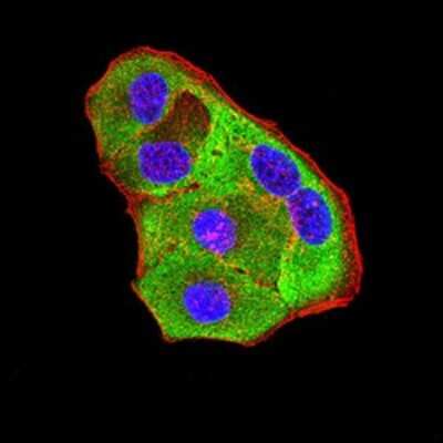 Immunocytochemistry/ Immunofluorescence: P2Y8 Antibody (1G5A2) - BSA Free [NBP2-61765]