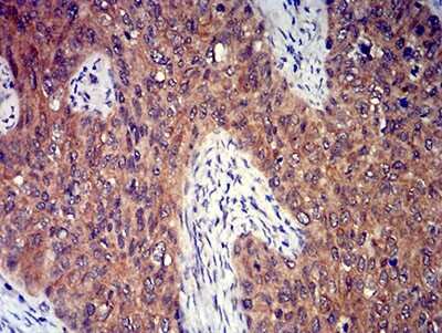 Immunohistochemistry-Paraffin: P2Y8 Antibody (1G5A2) - BSA Free [NBP2-61765]