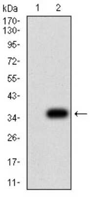 Western Blot: P2Y8 Antibody (1G5A2)BSA Free [NBP2-61765]