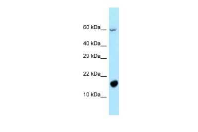 Western Blot: P311 Antibody [NBP2-83352]