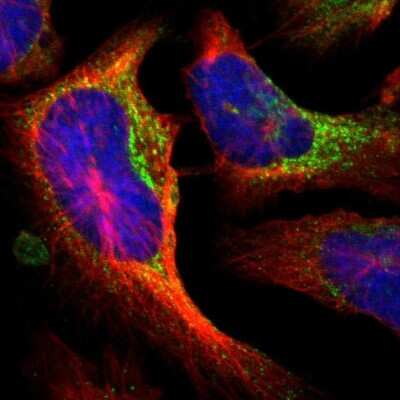 Immunocytochemistry/ Immunofluorescence: P4HA1 Antibody [NBP1-84398]