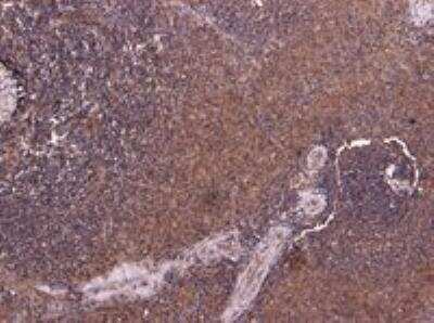 Immunohistochemistry-Paraffin: P4HA1 Antibody [NB100-57852]