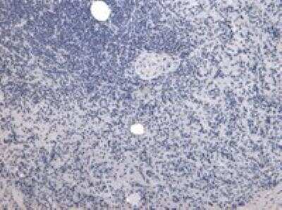 Immunohistochemistry-Paraffin: P4HA1 Antibody [NB100-57852]