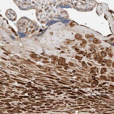 Immunohistochemistry-Paraffin: P4HA1 Antibody [NBP1-84398]