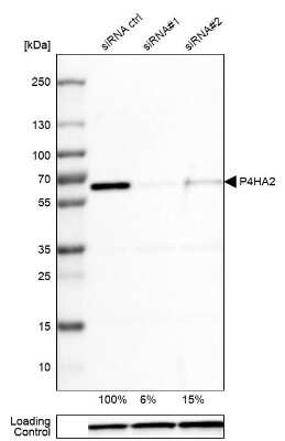 Western Blot: P4HA2 Antibody (CL0351) [NBP2-52922]