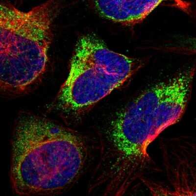 Immunocytochemistry/ Immunofluorescence: P4HA2 Antibody [NBP2-33878]