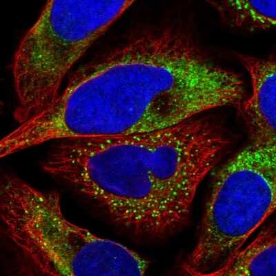 Immunocytochemistry/ Immunofluorescence: P4HA2 Antibody [NBP2-33909]
