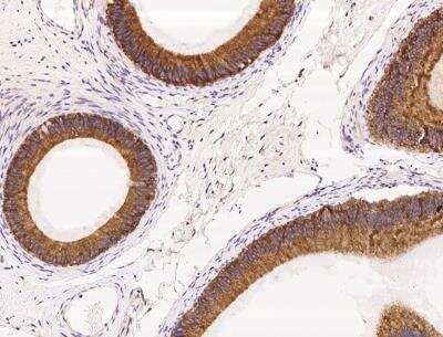 Immunohistochemistry-Paraffin: P4HA2 Antibody [NBP3-06468]