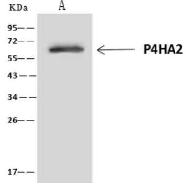 Immunoprecipitation: P4HA2 Antibody [NBP3-06468]