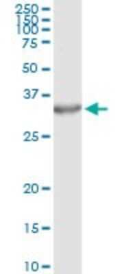 Immunoprecipitation: PA28 Activator beta Subunit/PSME2 Antibody (1G4) [H00005721-M02]