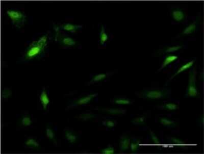 Immunocytochemistry/ Immunofluorescence: PA28 Activator beta Subunit/PSME2 Antibody (3F11-1A3) [H00005721-M01]