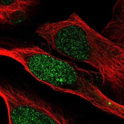 Immunocytochemistry/ Immunofluorescence: PA28 Activator beta Subunit/PSME2 Antibody [NBP2-57628]