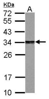 Western Blot: PA28 Activator gamma Subunit/PSME3 Antibody [NBP1-33498]