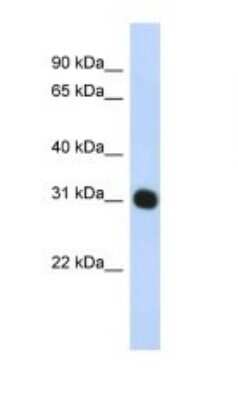 Western Blot: PA28 Activator gamma Subunit/PSME3 Antibody [NBP1-54587]