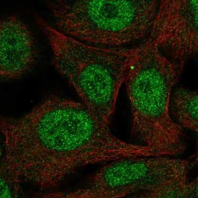 Immunocytochemistry/ Immunofluorescence: PAAF1 Antibody [NBP2-55195]