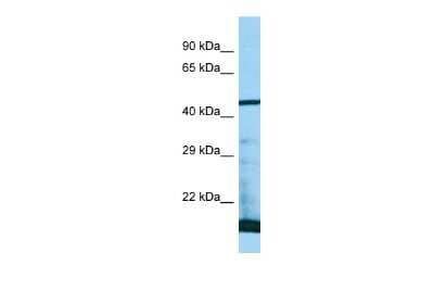 Western Blot: PAAF1 Antibody [NBP2-88002]