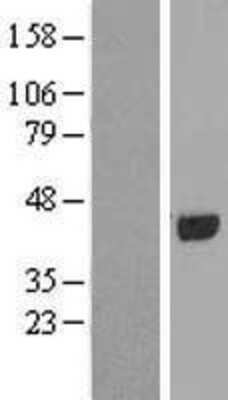 Western Blot: PAAF1 Overexpression Lysate [NBL1-14056]