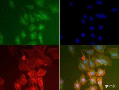 Immunocytochemistry/ Immunofluorescence: PABP Antibody (10E10) - Azide and BSA Free [NBP2-80901]