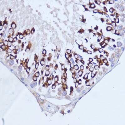 Immunohistochemistry-Paraffin: PABP Antibody - Azide and BSA Free [NBP2-93914]