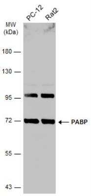 Western Blot: PABP Antibody [NBP2-19670]
