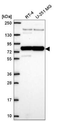 Western Blot: PABP Antibody [NBP2-57869]