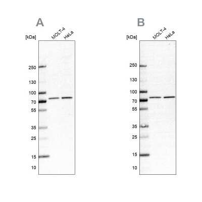 Western Blot: PABP Antibody [NBP2-57869]