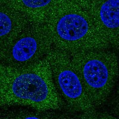 Immunocytochemistry/ Immunofluorescence: PABPC1L Antibody [NBP2-55978]