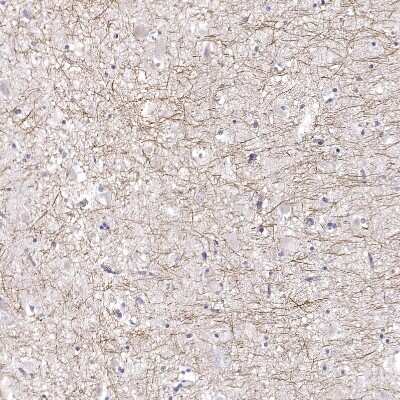 Immunohistochemistry-Paraffin: PABPC1L2A Antibody [NBP2-54693]