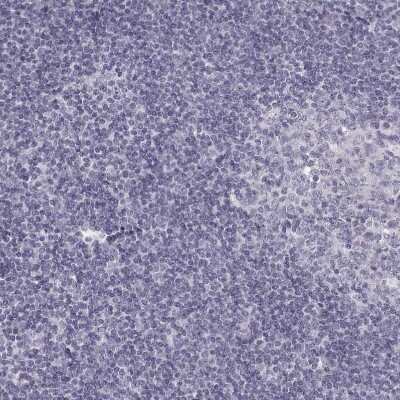 Immunohistochemistry-Paraffin: PABPC1L2A Antibody [NBP2-54693]