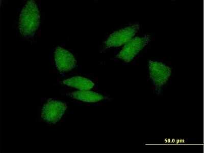 Immunocytochemistry/ Immunofluorescence: PABPC3 Antibody [H00005042-B01P]