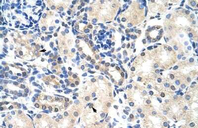 Immunohistochemistry-Paraffin: PABPC4 Antibody [NBP1-57448]