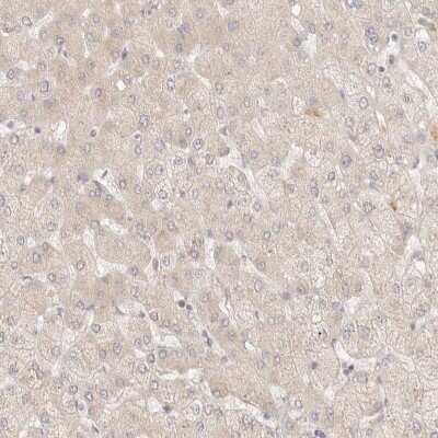 Immunohistochemistry-Paraffin: PABPC4 Antibody [NBP2-13722]