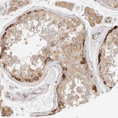 Immunohistochemistry-Paraffin: PABPC4 Antibody [NBP2-13722]