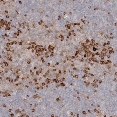 Immunohistochemistry-Paraffin: PABPC4 Antibody [NBP2-13722]